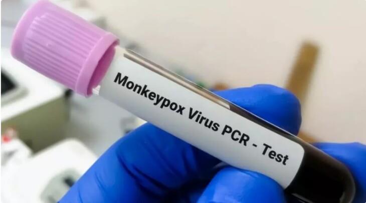 Prefeitura de Guaxupé descarta 7º caso suspeito de varíola do macaco no município