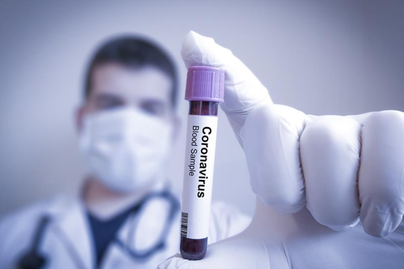 Por que isolamento, máscaras e higiene das mãos resultam em mais sobreviventes da virose do novo Coronavírus?